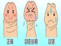 第三代供卵代生促排卵药怎样选？国产药好仍是进口药好？