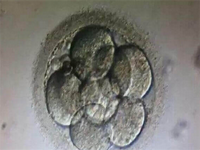 泉州在哪可以做试管婴儿？泉州有做试管婴儿的医院吗？